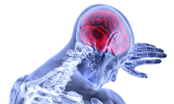 Stroke Juga Rentan Sasar Usia Muda stroke-juga-rentan-sasar-usia-muda