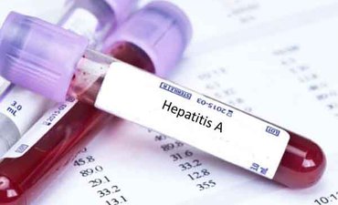 Dinkes Jatim Belum Turunkan Penanganan Hepatitis A dinkes-jatim-belum-turunkan-penanganan-hepatitis-a